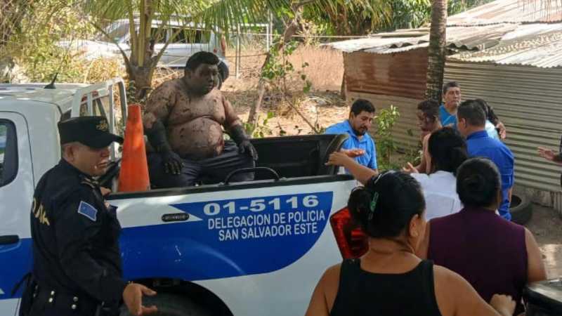 Unidades de Comandos de Salvamento y la PNC trasladan a víctimas de la explosión en una cohetería de la Comunidad Los Naranjos.  Fotos: Comandos de Salvamento